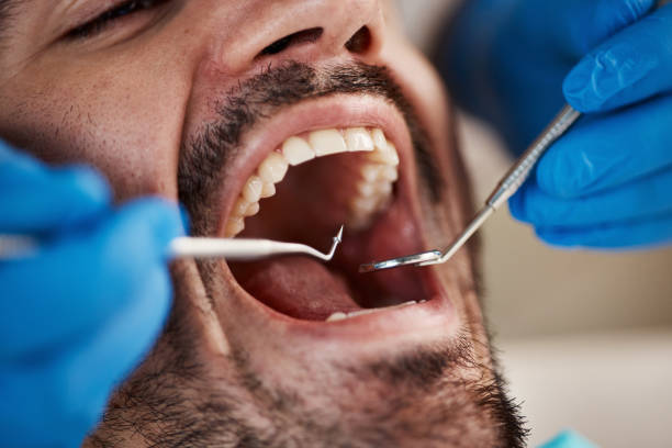Oral Cancer Screening in Church Rock, NM
